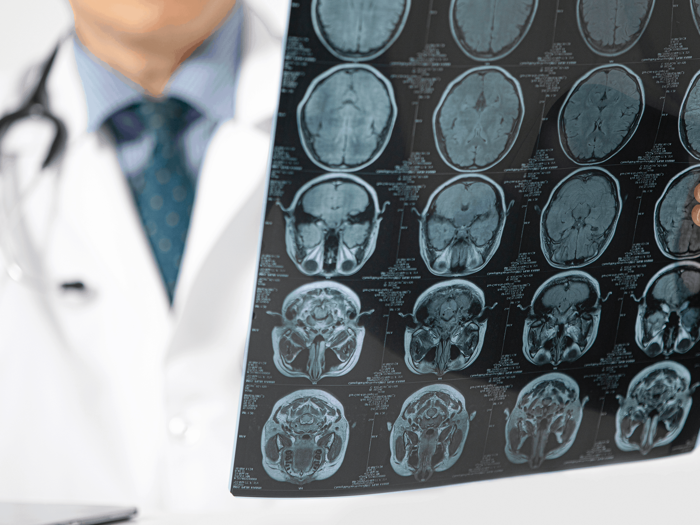 Neurosurgeon examines brain scans before advising any neurosurgery procedures