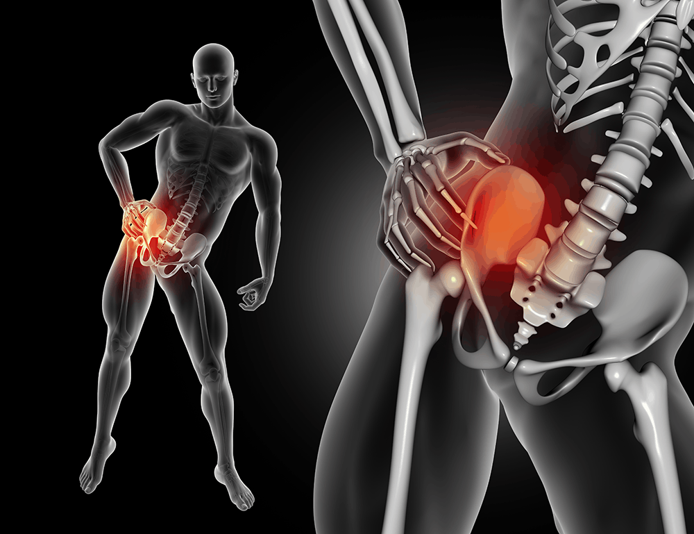 Pain in your lower back when standing up could be relieved by SI Joint Fusion