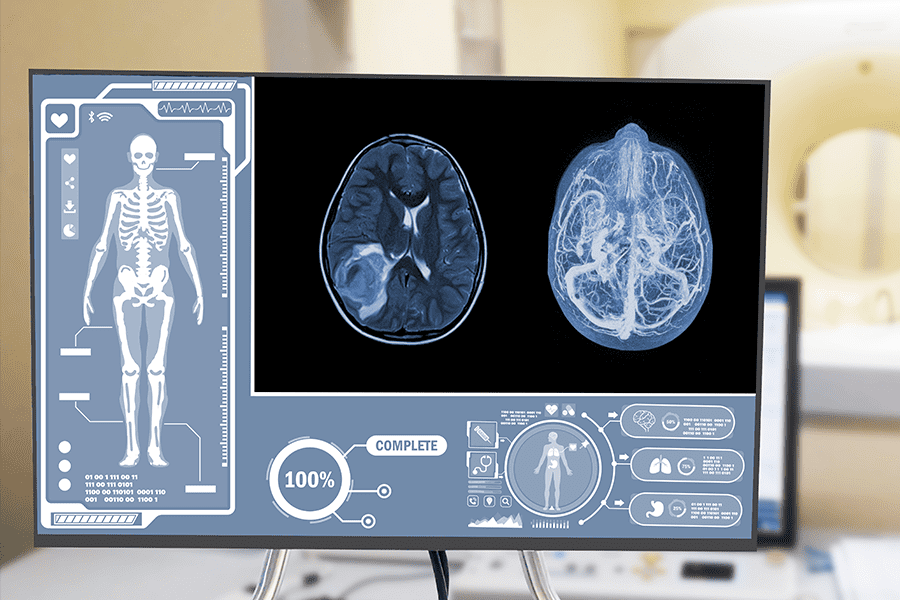 A computer monitor contains the results of a brain scan 